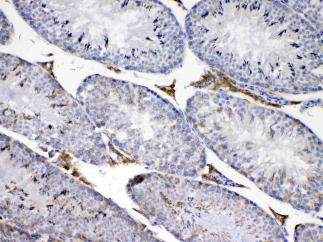 CP110 Antibody in Immunohistochemistry (Paraffin) (IHC (P))