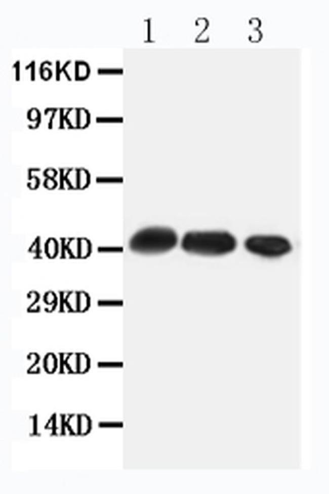 CCR4 Antibody in Western Blot (WB)