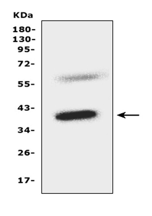 CCR5 Antibody in Western Blot (WB)