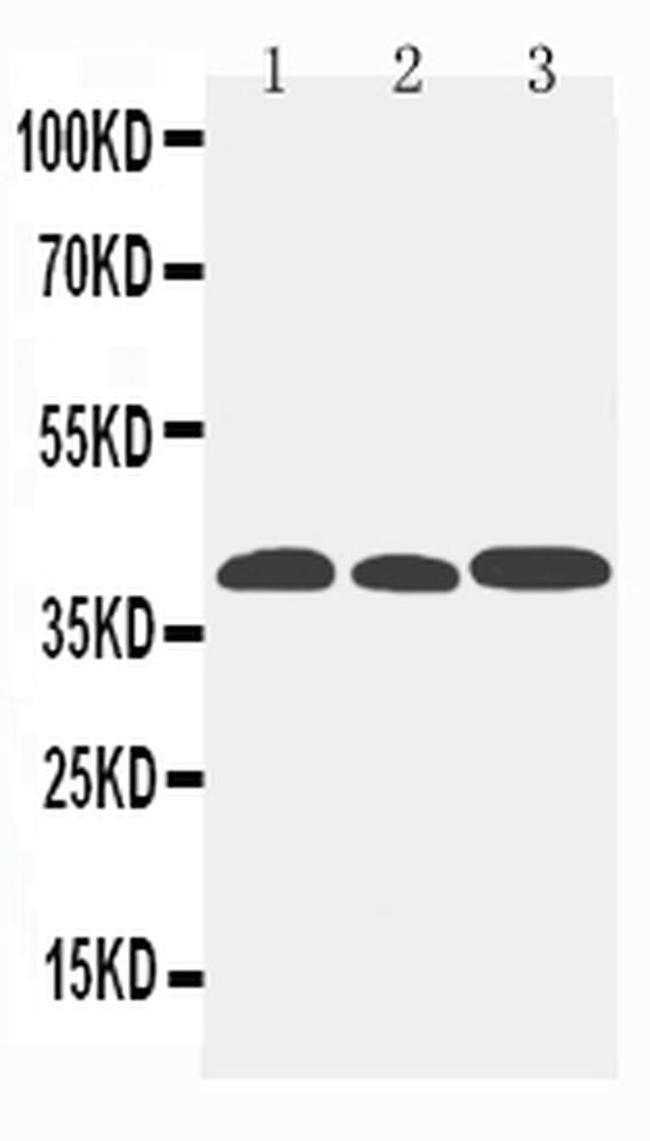 CCR5 Antibody in Western Blot (WB)