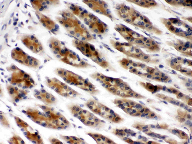 TCP-1 beta Antibody in Immunohistochemistry (Paraffin) (IHC (P))