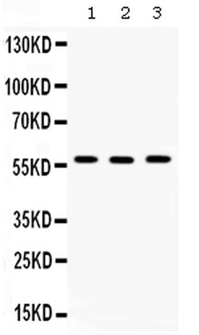 TCP-1 beta Antibody in Western Blot (WB)