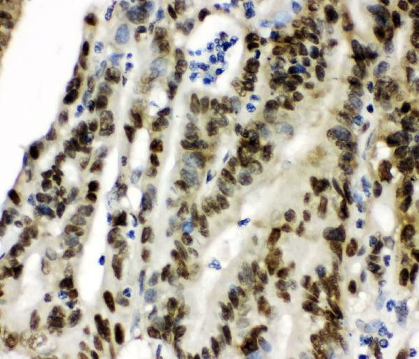 CCT3 Antibody in Immunohistochemistry (Paraffin) (IHC (P))