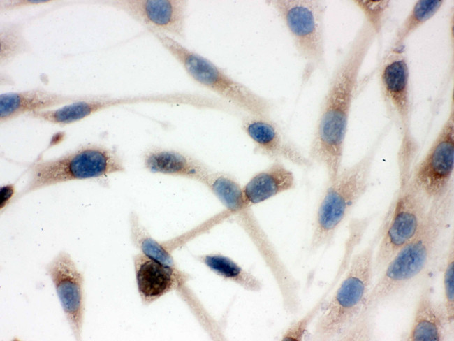 TCP-1 delta Antibody in Immunocytochemistry (ICC/IF)