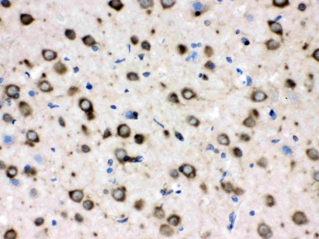 TCP-1 delta Antibody in Immunohistochemistry (Paraffin) (IHC (P))