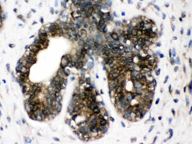 TCP-1 delta Antibody in Immunohistochemistry (Paraffin) (IHC (P))