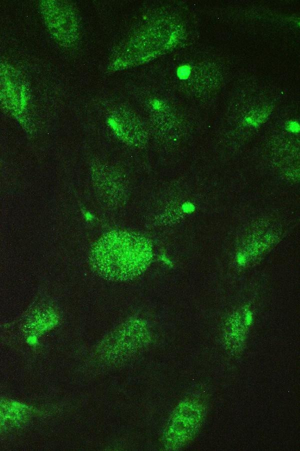 TCP-1 delta Antibody in Immunocytochemistry (ICC/IF)