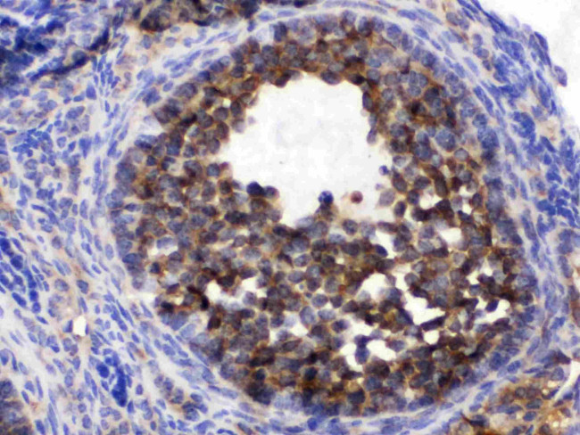 TCP1 epsilon Antibody in Immunohistochemistry (Paraffin) (IHC (P))