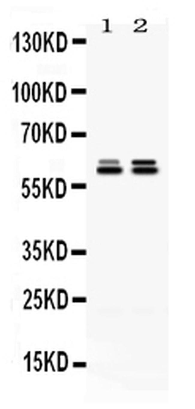 TCP1 epsilon Antibody in Western Blot (WB)