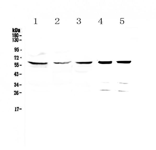 TCP1 eta Antibody in Western Blot (WB)