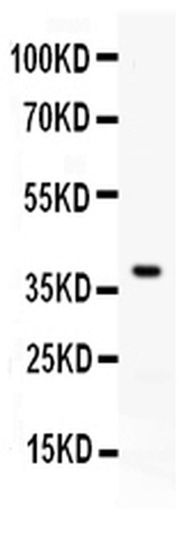 PD-L1 (CD274) Antibody in Western Blot (WB)