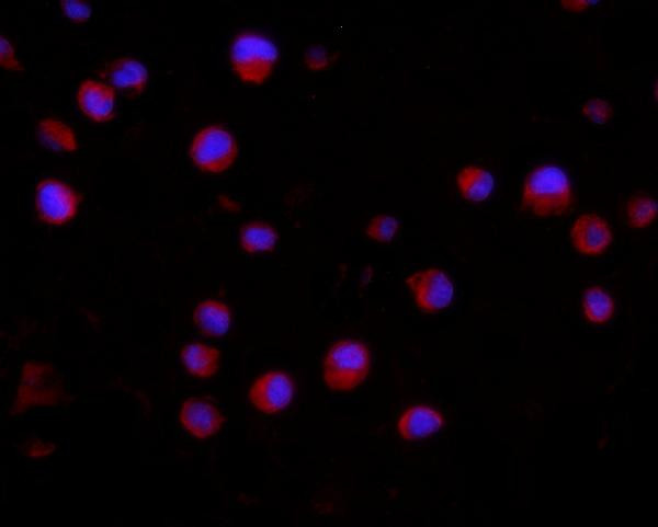 CD2AP Antibody in Immunocytochemistry (ICC/IF)