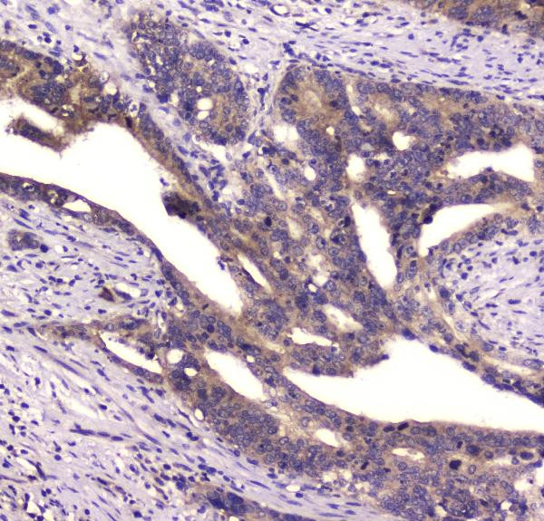 CD2AP Antibody in Immunohistochemistry (Paraffin) (IHC (P))