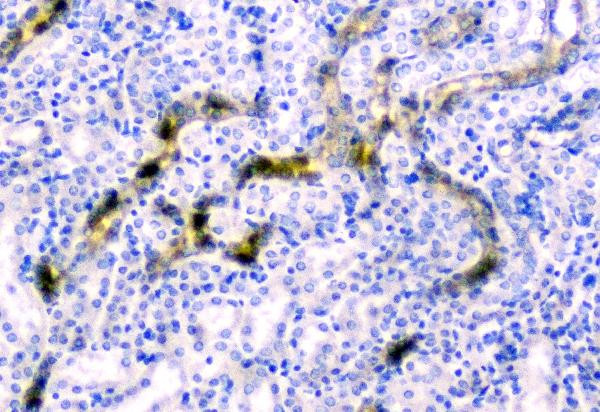 CD2AP Antibody in Immunohistochemistry (Paraffin) (IHC (P))