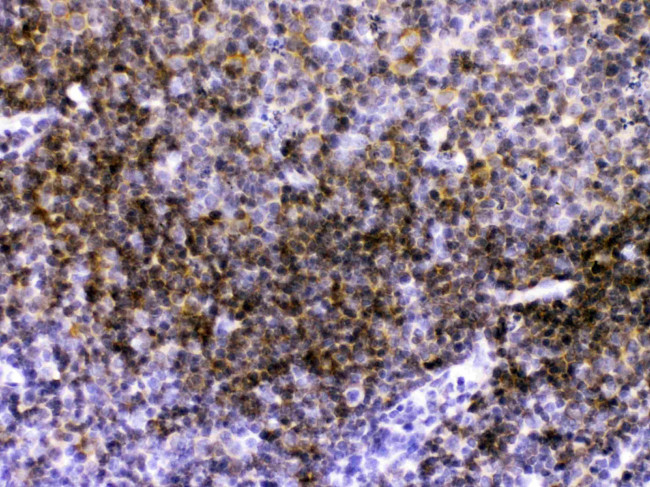 CD40 Antibody in Immunohistochemistry (Paraffin) (IHC (P))