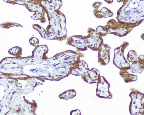 CD46 Antibody in Immunohistochemistry (Paraffin) (IHC (P))