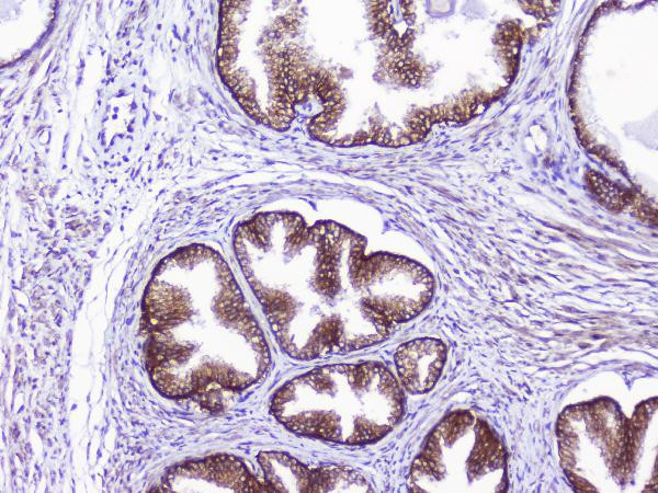 CD46 Antibody in Immunohistochemistry (Paraffin) (IHC (P))