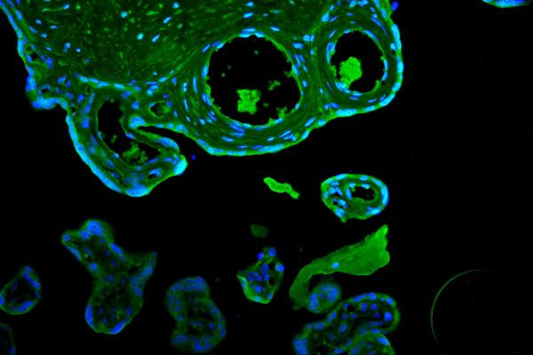 CD55 Antibody in Immunohistochemistry (IHC)