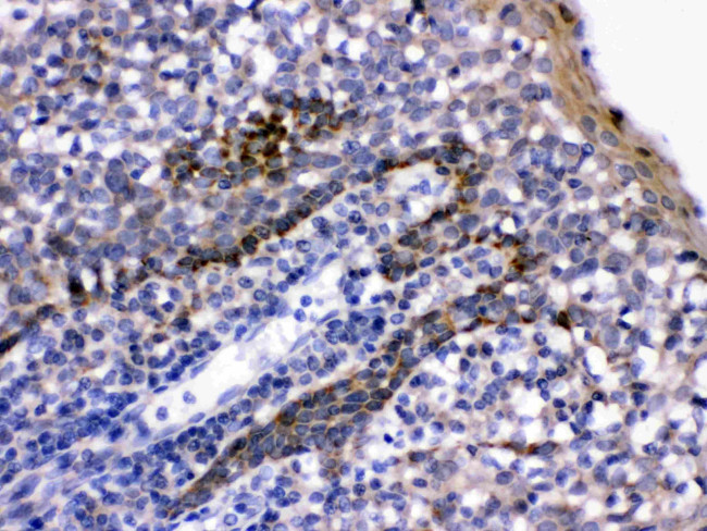 CD58 Antibody in Immunohistochemistry (Paraffin) (IHC (P))