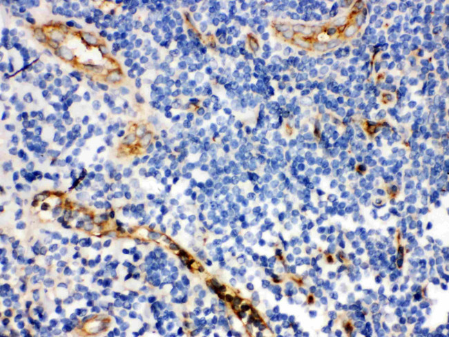 CD59 Antibody in Immunohistochemistry (Paraffin) (IHC (P))