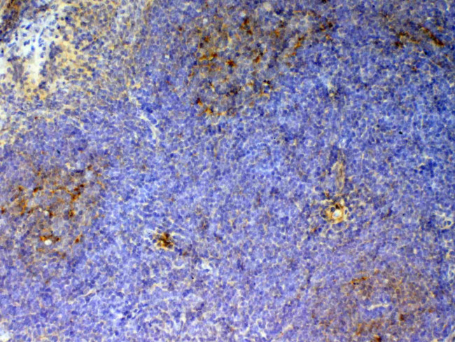 CD59 Antibody in Immunohistochemistry (Paraffin) (IHC (P))