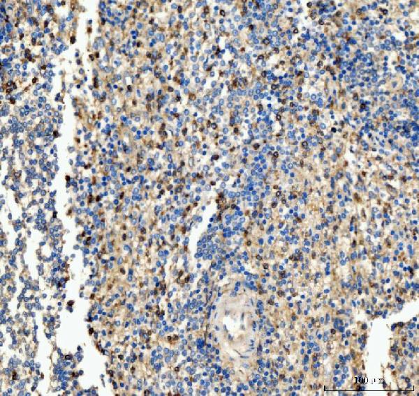 CD63 Antibody in Immunohistochemistry (Paraffin) (IHC (P))