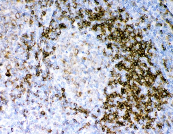 CD79a Antibody in Immunohistochemistry (Paraffin) (IHC (P))