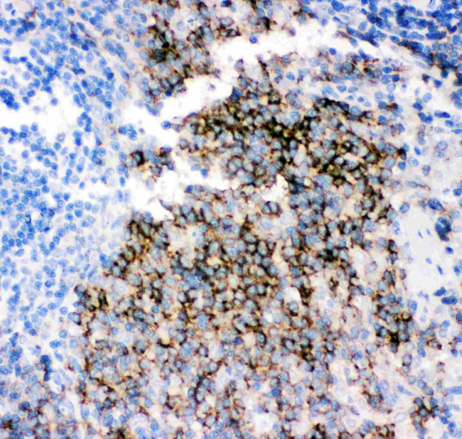 CD79b Antibody in Immunohistochemistry (Paraffin) (IHC (P))