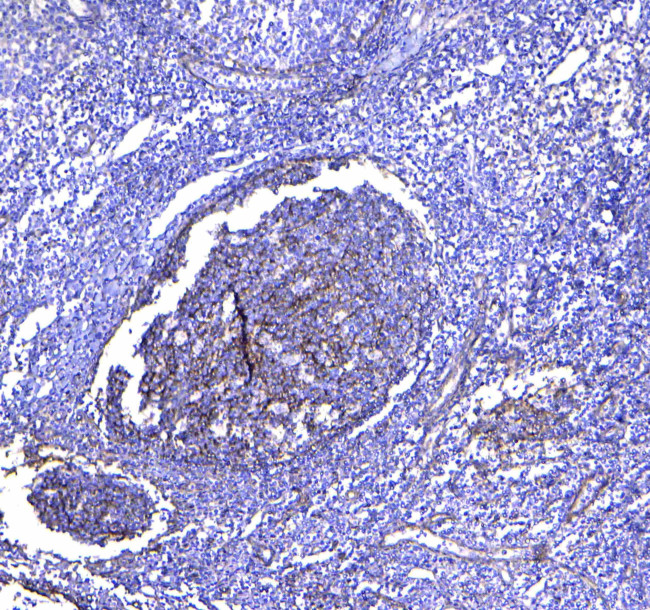 CD81 Antibody in Immunohistochemistry (Paraffin) (IHC (P))