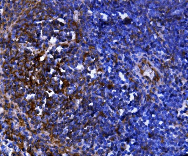 CD81 Antibody in Immunohistochemistry (Paraffin) (IHC (P))