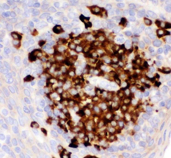 CD82 Antibody in Immunohistochemistry (Paraffin) (IHC (P))