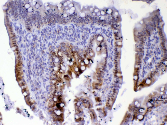 CDC20 Antibody in Immunohistochemistry (Paraffin) (IHC (P))