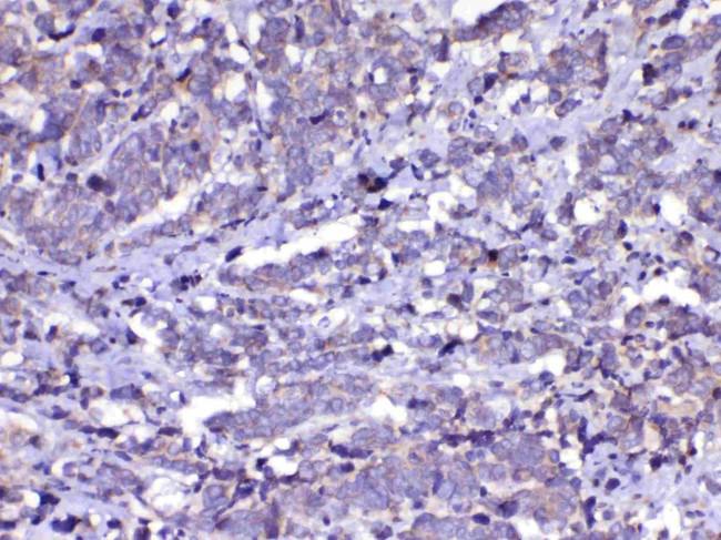 CDC20 Antibody in Immunohistochemistry (Paraffin) (IHC (P))