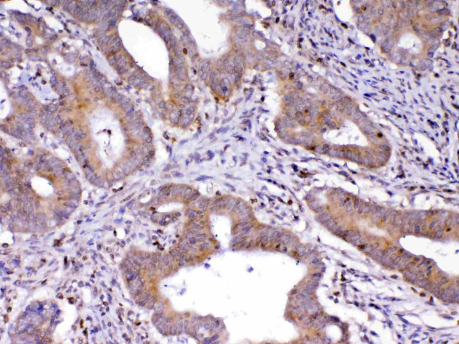 CDC20 Antibody in Immunohistochemistry (Paraffin) (IHC (P))