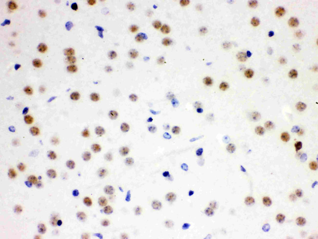 CDC25B Antibody in Immunohistochemistry (Paraffin) (IHC (P))