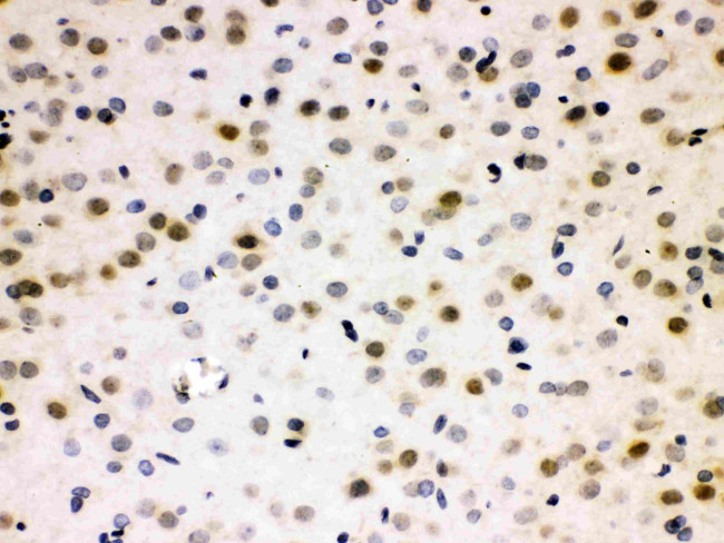 CDC25B Antibody in Immunohistochemistry (Paraffin) (IHC (P))