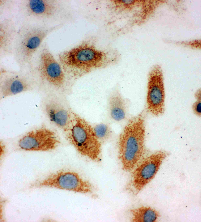 P-cadherin Antibody in Immunocytochemistry (ICC/IF)