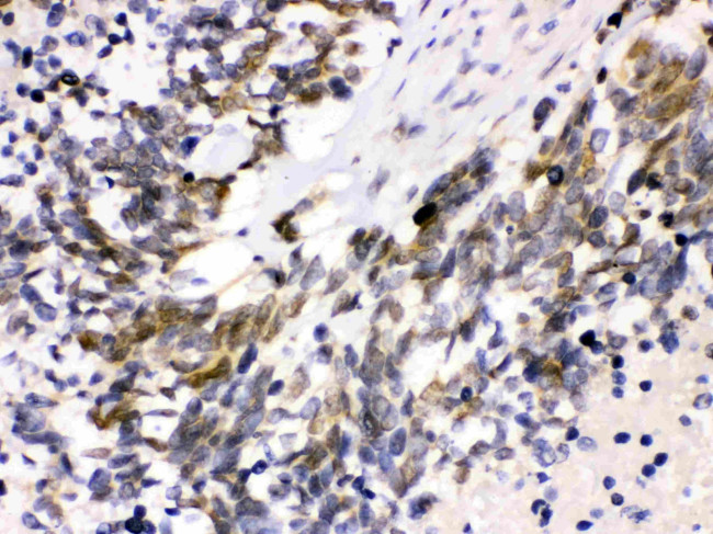 CDK4 Antibody in Immunohistochemistry (Paraffin) (IHC (P))