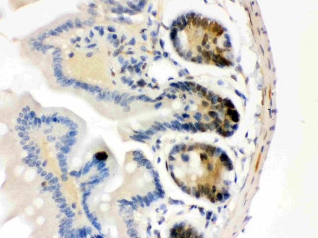 CDK4 Antibody in Immunohistochemistry (Paraffin) (IHC (P))