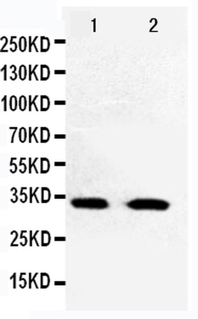 CDK5 Antibody in Western Blot (WB)