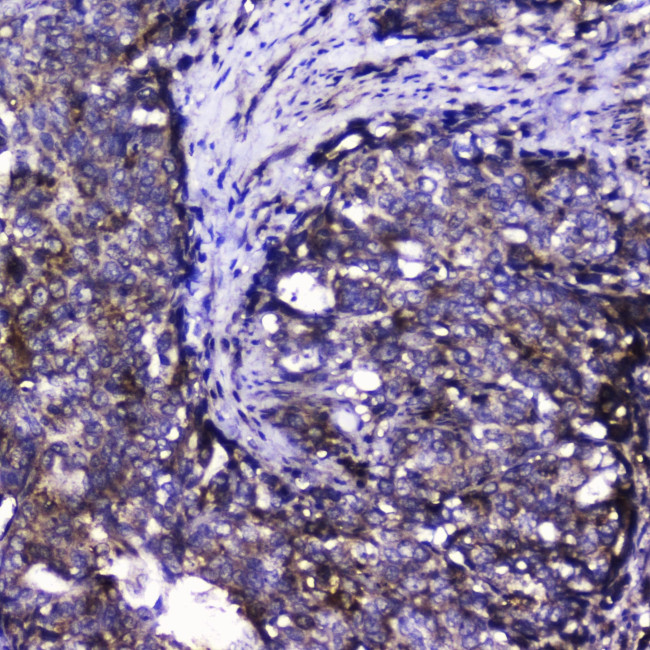 CDK6 Antibody in Immunohistochemistry (Paraffin) (IHC (P))