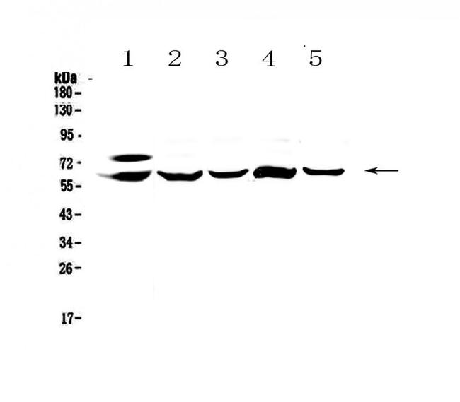 CES1 Antibody in Western Blot (WB)