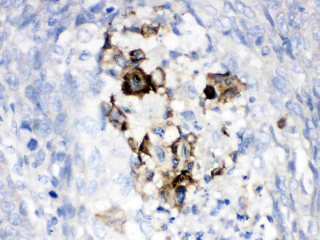 Complement Factor B Antibody in Immunohistochemistry (Paraffin) (IHC (P))