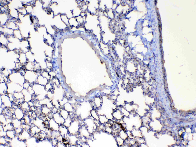 Factor D Antibody in Immunohistochemistry (Paraffin) (IHC (P))