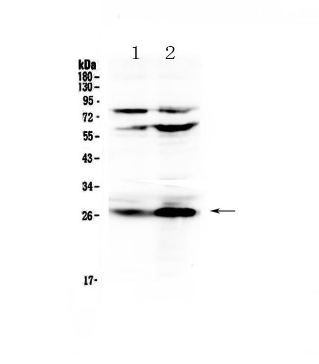 Factor D Antibody in Western Blot (WB)