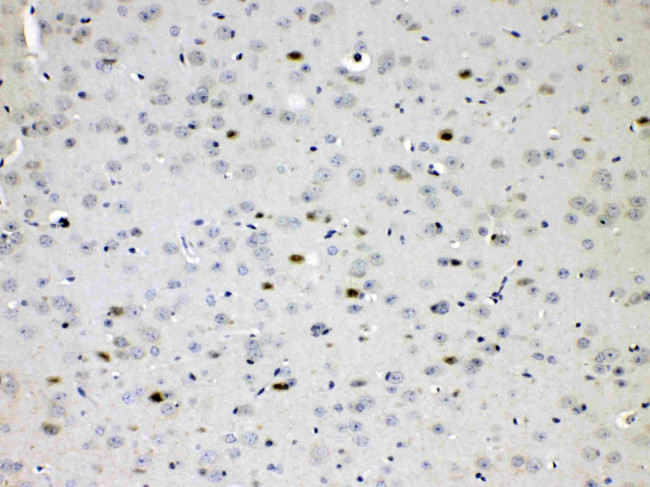 ChAT Antibody in Immunohistochemistry (Paraffin) (IHC (P))