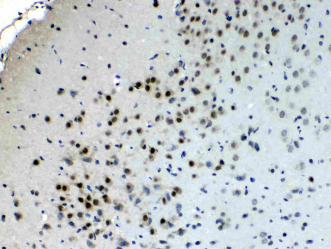 ChAT Antibody in Immunohistochemistry (Paraffin) (IHC (P))