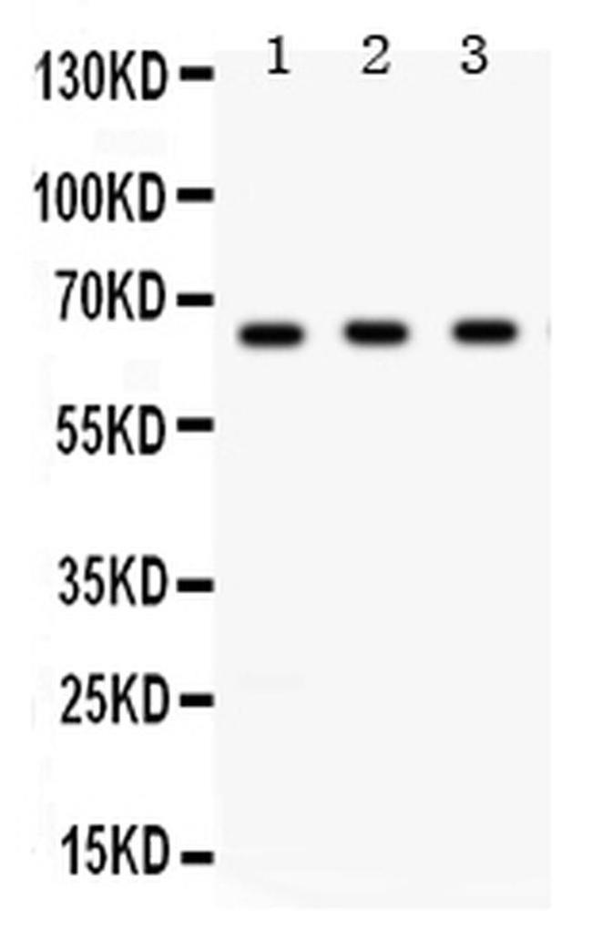 CHK2 Antibody in Western Blot (WB)