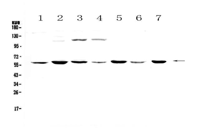 CHRNA3 Antibody in Western Blot (WB)