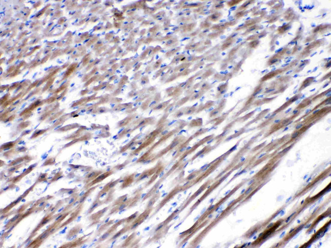 CHRNA5 Antibody in Immunohistochemistry (Paraffin) (IHC (P))